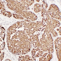  - Anti-MUC1 Antibody AP61609